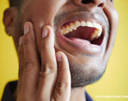 Are-Yellow-Teeth-Always-Unhealthy-What-Your-Tooth-Shade-Means