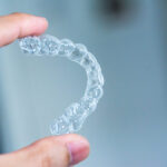 Do-Teens-and-Adults-Get-the-Same-Invisalign-Experience
