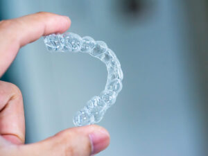 Do-Teens-and-Adults-Get-the-Same-Invisalign-Experience
