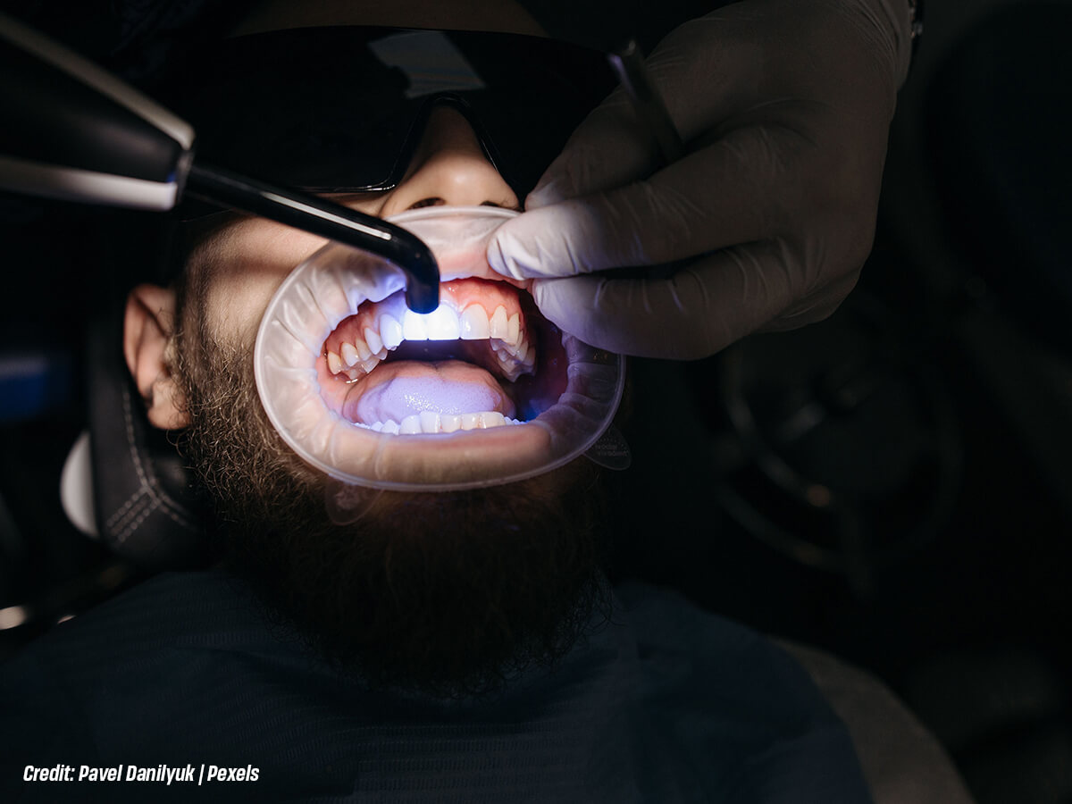 How-Can-You-Safely-Brighten-Yellow-Teeth